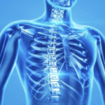 Implantable Device May Help Restore Function Lost Due to SCI